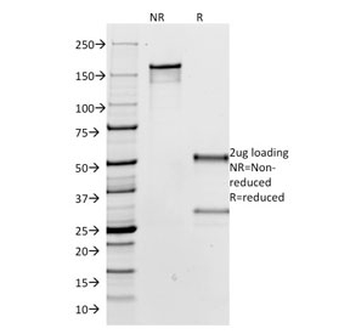 IgG Heavy Chain Antibody