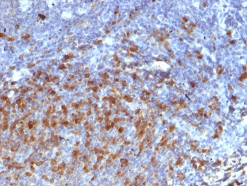 IgG Antibody