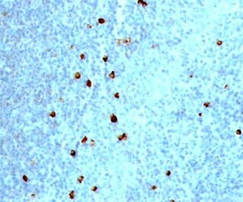 IgM Heavy Chain Antibody