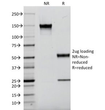 Kappa Light Chain Antibody