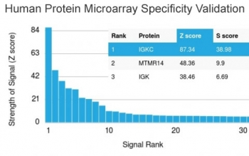 Kappa Light Chain Antibody