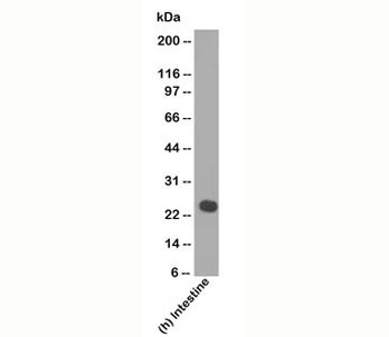 Lambda Light Chain Antibody