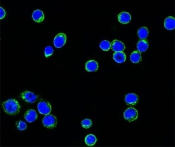 Lambda Light Chain Antibody