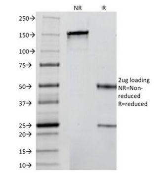 Insulin Antibody