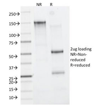 CD11b Antibody / MAC-1 / ITGAM