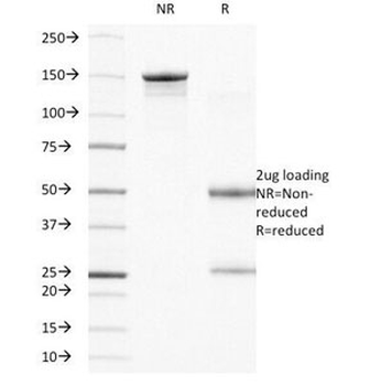Integrin Beta 4 Antibody / ITGB4 / CD104