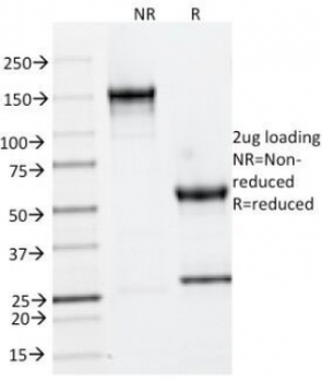 Keratin 6 Antibody / Cytokeratin 6