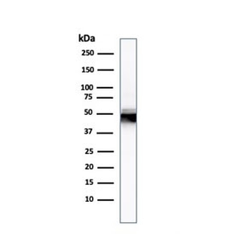 KRT8 Antibody / Cytokeratin 8