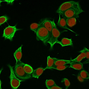 KRT8 Antibody / Cytokeratin 8