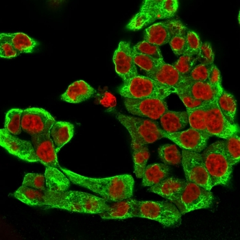 KRT8 Antibody / Cytokeratin 8