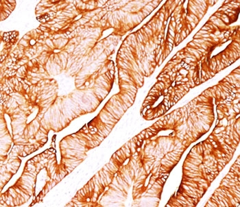 KRT8 Antibody / Cytokeratin 8