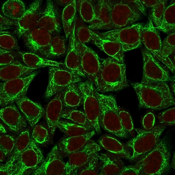 KRT8 Antibody / Cytokeratin 8