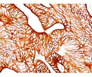 KRT8 Antibody / Cytokeratin 8