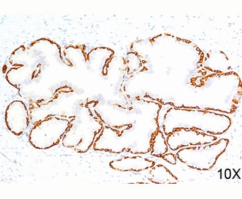 Cytokeratin 14 Antibody / CK14 / KRT14