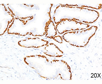Cytokeratin 14 Antibody / CK14 / KRT14