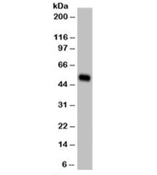 Cytokeratin 14 Antibody / CK14 / KRT14