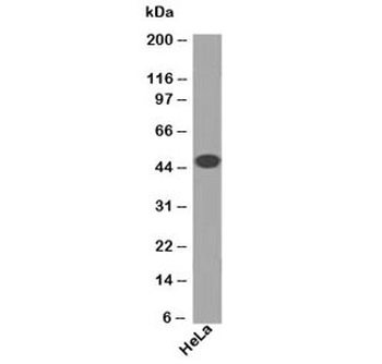 Cytokeratin 18 Antibody