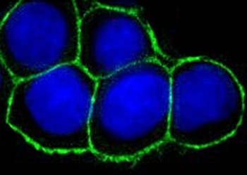 EpCAM Antibody