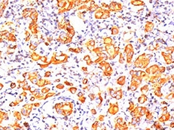 MUC1 Antibody / Mucin-1