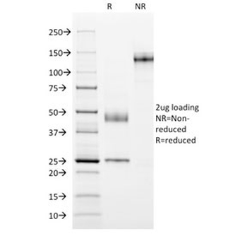 MUC1 Antibody / Mucin-1