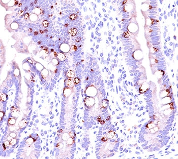 MUC2 Antibody / Mucin-2