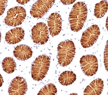 MUC5AC Antibody / Mucin-5AC