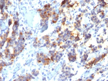 MUC5AC Antibody / Mucin-5AC