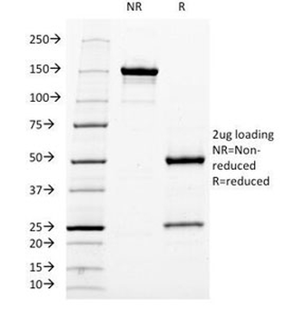 Neurofilament Antibody (-Heavy) / NF-H / NEFH