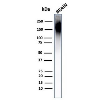 Neurofilament Antibody (-Heavy) / NF-H / NEFH