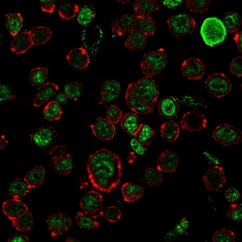 Neurofilament Antibody (-Heavy) / NF-H / NEFH
