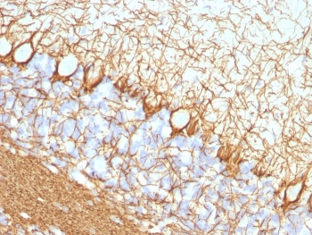 Neurofilament Antibody (-Heavy) / NF-H / NEFH