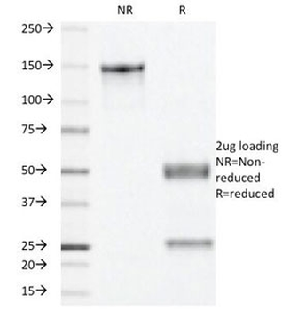 Progesterone Receptor Antibody