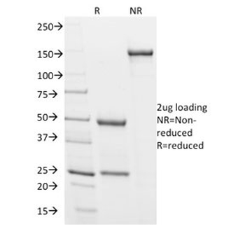 Podocalyxin Antibody / PODXL