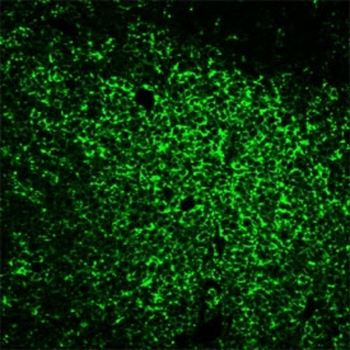CD45RO Antibody (T-cell marker)