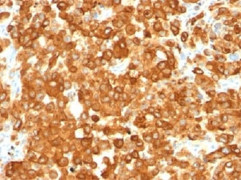 PMEL17 / Melanoma gp100 Antibody