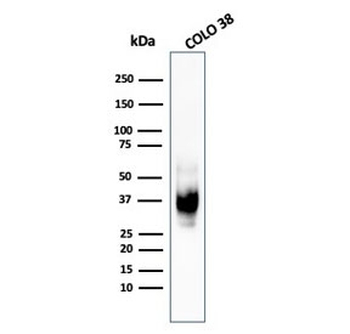 PMEL17 / Melanoma gp100 Antibody