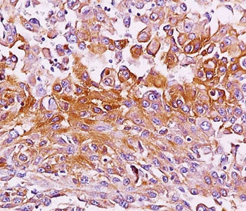 Melanoma Antibody / gp100 / PMEL17