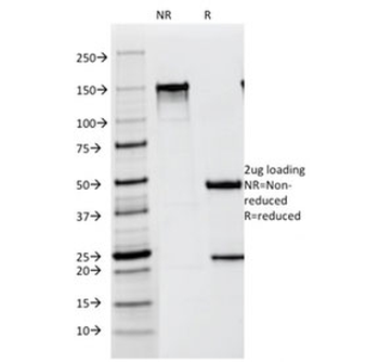 Melanoma Antibody / gp100 / PMEL17