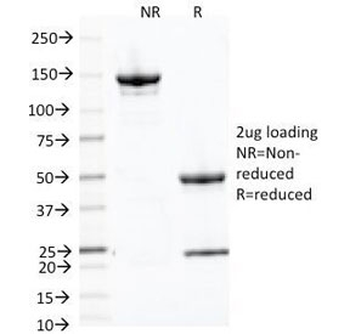 Transferrin Receptor Antibody / CD71
