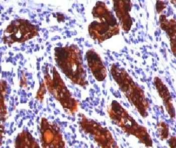 Thyroglobulin Antibody