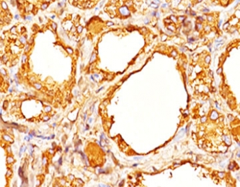 Thyroglobulin Antibody Cocktail