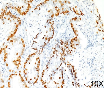 TTF-1 Antibody / NKX2.1