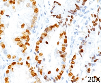 TTF-1 Antibody / NKX2.1