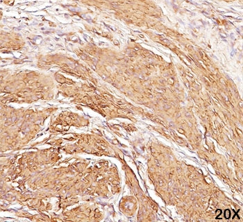 Muscle Actin Antibody (pan)