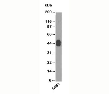 Acidic Cytokeratin Antibody