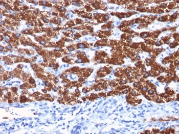 Hep Par 1 Antibody / Hepatocyte Paraffin 1