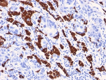 Hep Par 1 Antibody / Hepatocyte Paraffin 1