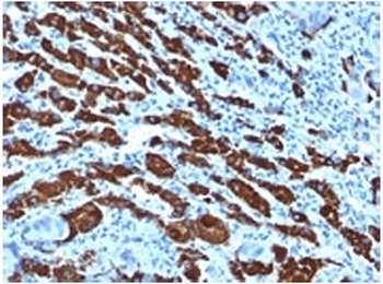 Hep Par 1 Antibody / Hepatocyte Paraffin 1