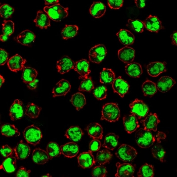 Human Nuclear Antigen Antibody