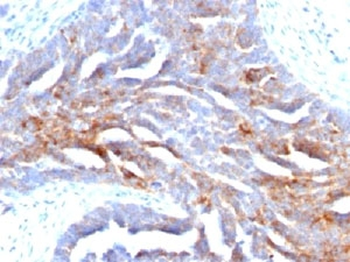 TAG-72 Antibody